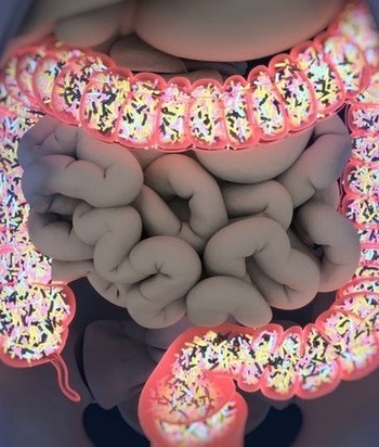 Roli i baktereve intestinale në zhvillimin e aterosklerozës koronare